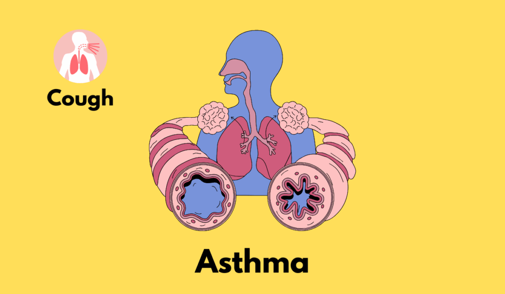 Illustration of lungs and representation of asthma and relating it with cough