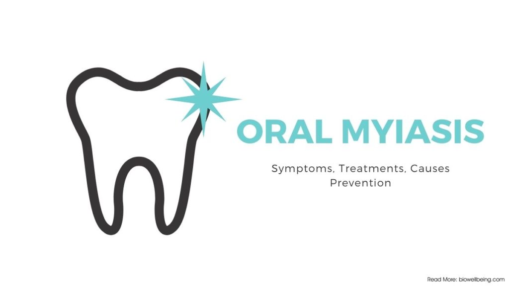 Image showing graphics of teeth and oral myiasis