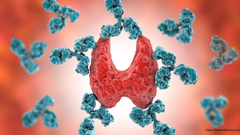 image showing thyroid and antibodies, common autoimmune disease in India