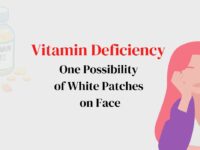 Vitamin Deficiency: One Possibility of White Patches on Face