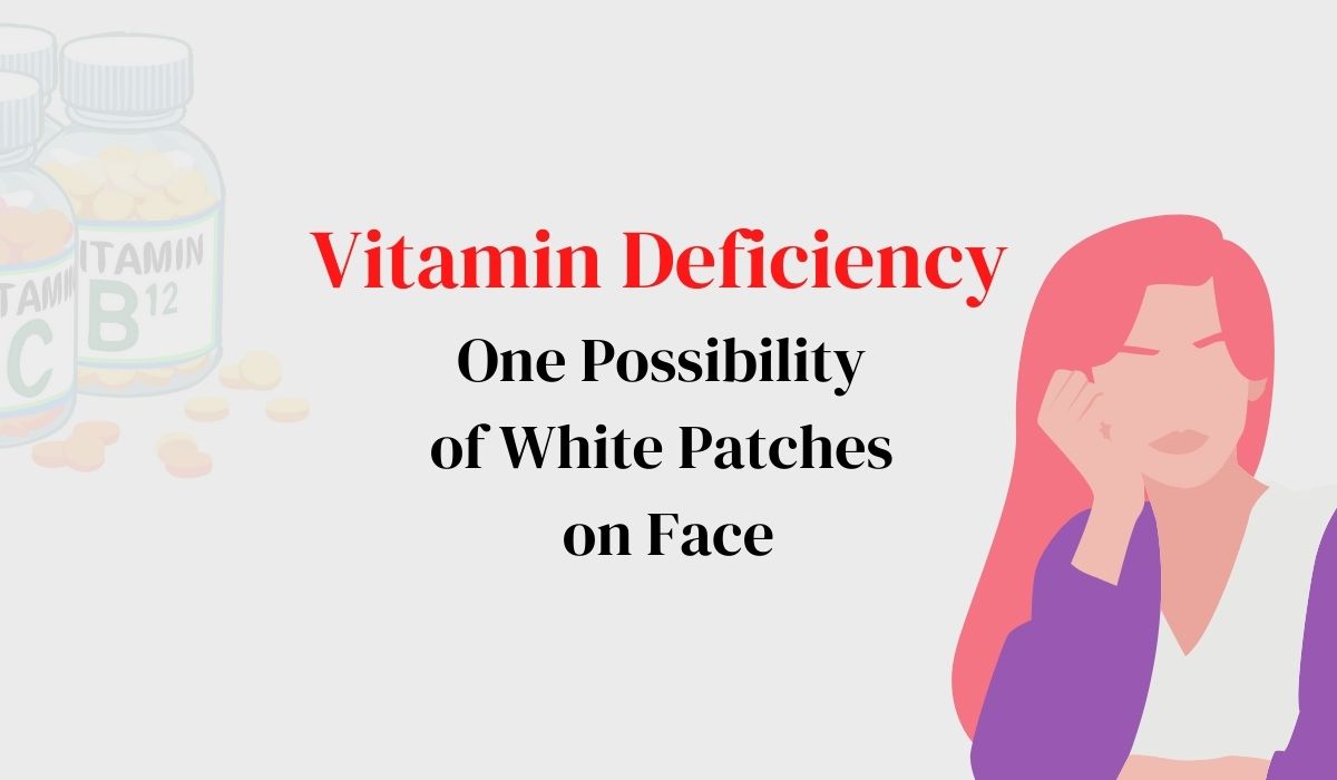 Vitamin deficiency One possibility of White patches on face