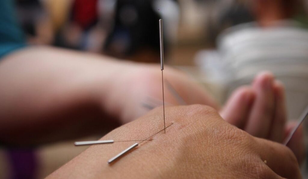 Reasons Acupuncture Help Treat Lower Back Pain