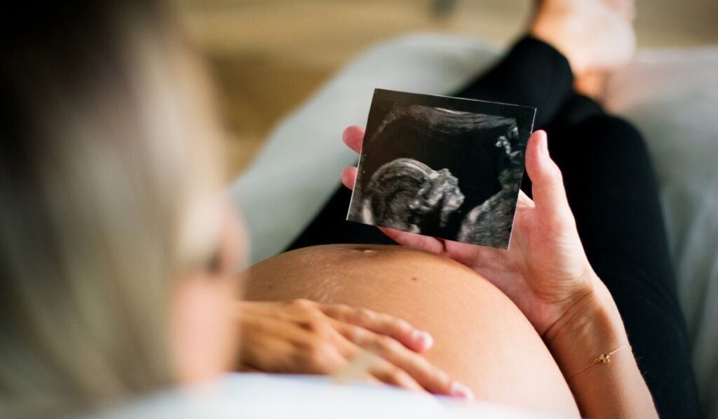 pregnant woman and sonogram image