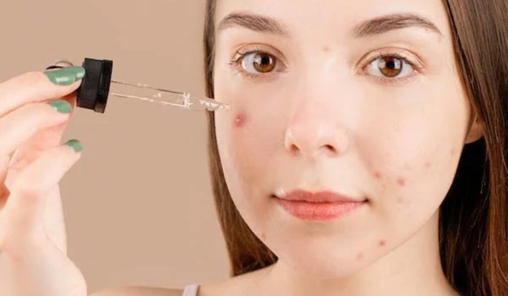 Image showing women applying essential oil on irritable skin